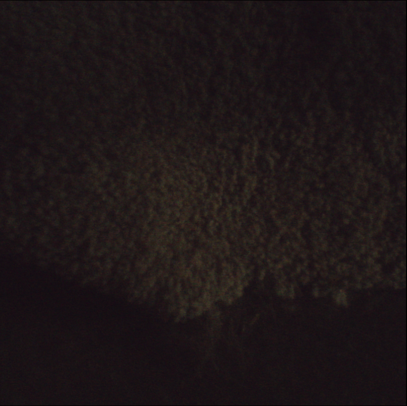 left frame